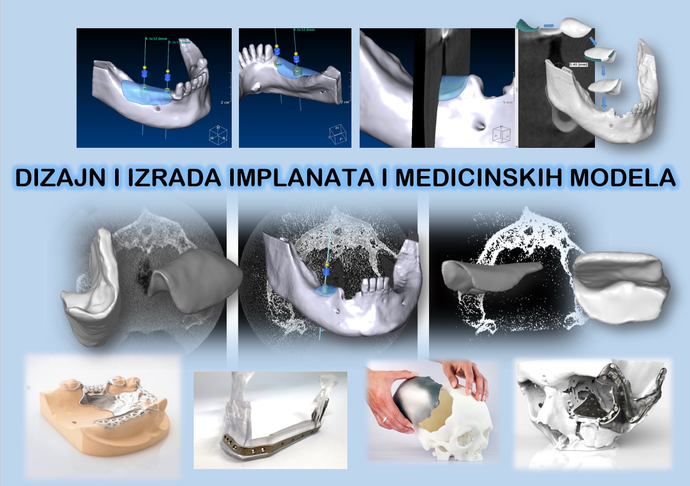DIIMM Cover